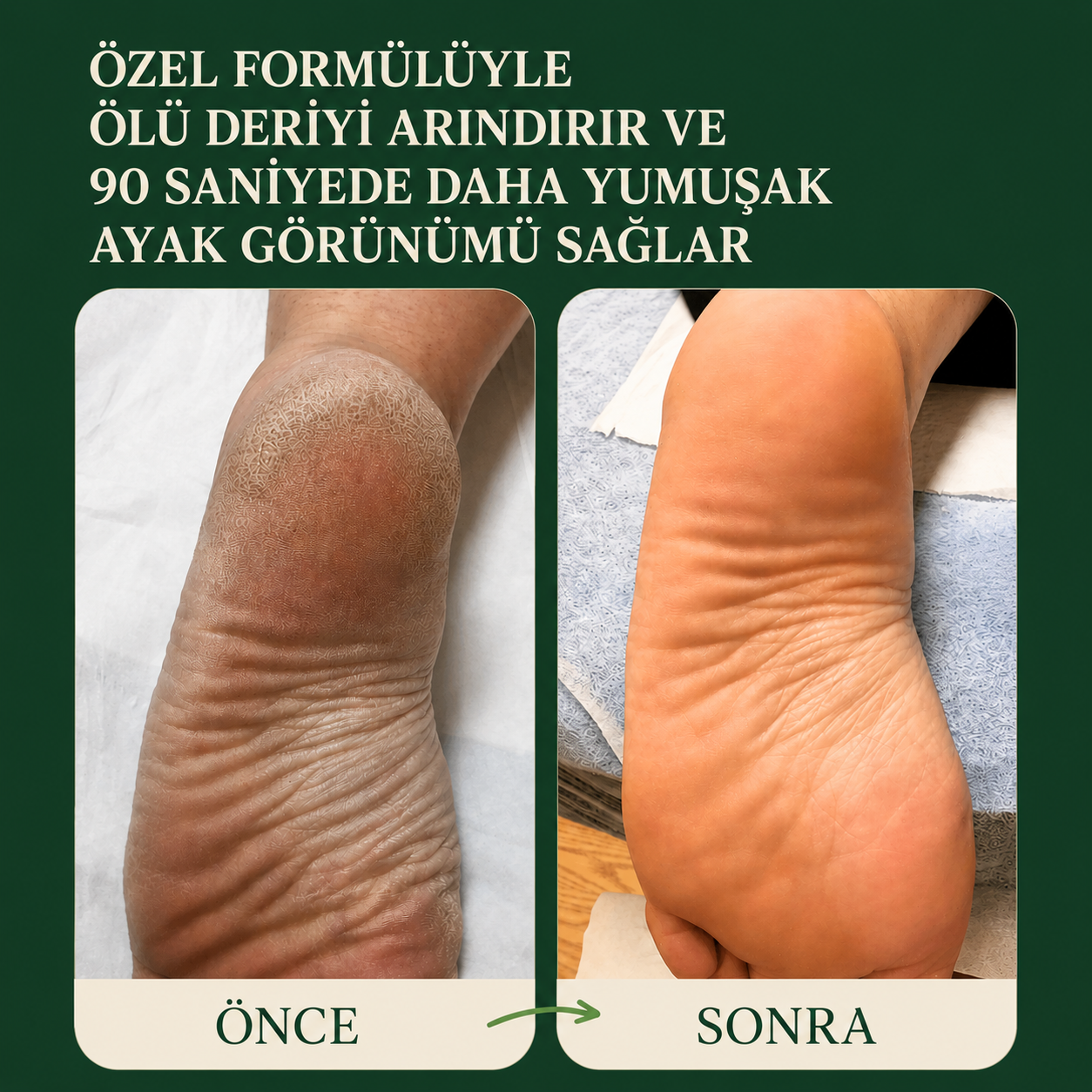 Cleona Anında Etkili Ayak Peeling Spreyi